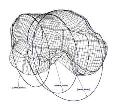 Artificial Ankle Rendering